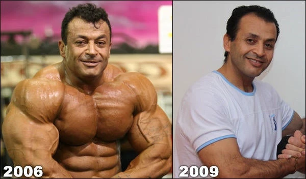 Εικόνες που σοκάρουν – Bodybuilders δεν θυμίζουν σε τίποτα αυτό που ήταν
